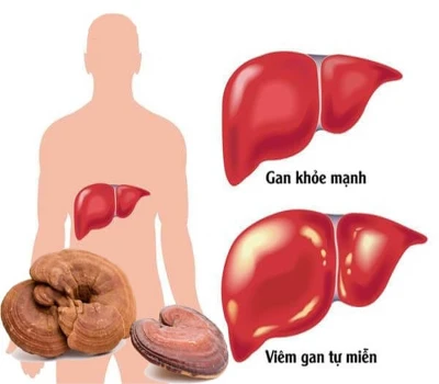 Linh Chi: Siêu Thực Phẩm Cho Sức Khỏe Tim Mạch